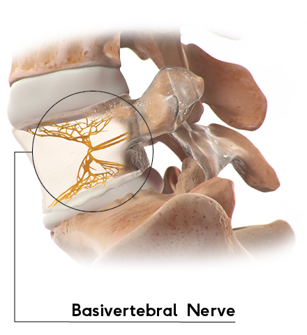 The cause of your chronic lower back pain - Vertebrogenic pain